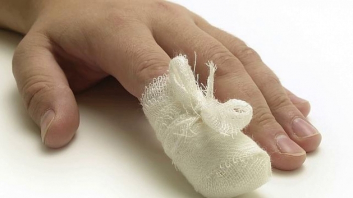 В Запорожье из-за кольца у ребенка распух палец
