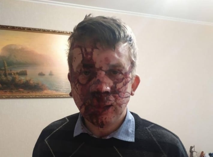 Избитый депутат Запорожского областного совета рассказал подробности нападения (видео)