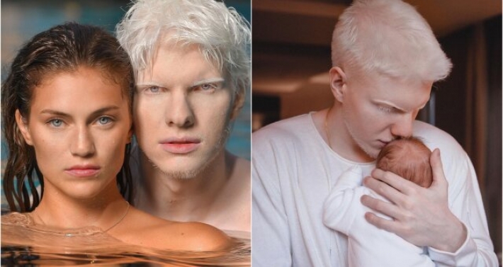 Известный музыкант-альбинос показал подросшего сына: как выглядит малыш сейчас и похож ли он на своего отца (Фото)