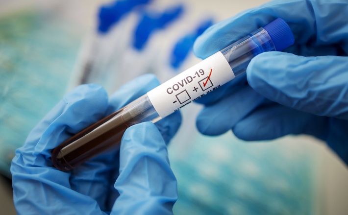 В Мелитополе количество заболевших коронавирусом перевалило за пять тысяч