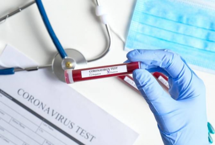 В Мелитополе 41 новый случай заболевания коронавирусом