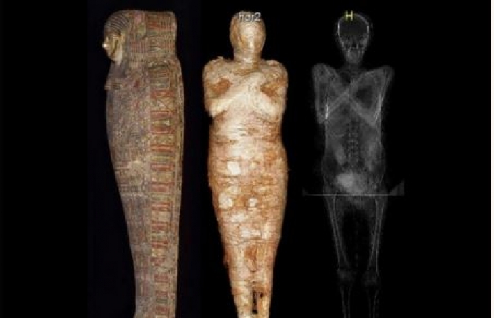 Ученые обнаружили первую в мире беременную мумию (фото)