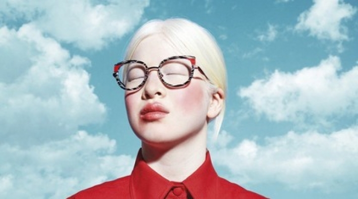 Родители бросили дочь с альбинизмом из-за "проклятия" - в 16 лет она стала моделью Vogue