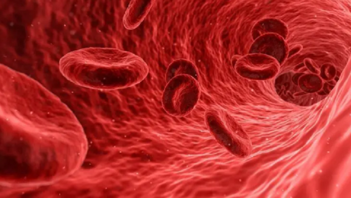 В Индии врач показал длинный "коронавирусный" кровяной тромб, извлеченный у пациента