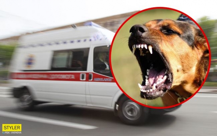 В Ровно собака напала на маленькую девочку и вцепилась в лицо: малышку прооперировали