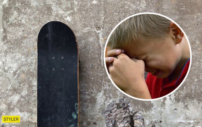 В Тернополе мать избила скейтом 10-летнего сына: у ребенка множественные ушибы головы