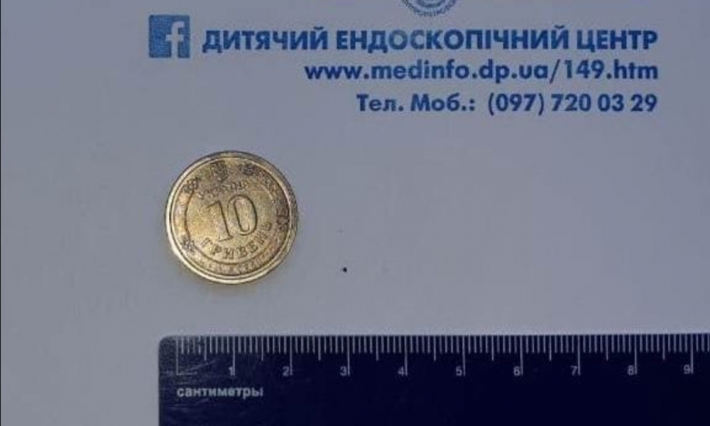 В Днепре подросток проглотил десятигривневую монету (фото)