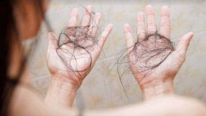 Четыре ошибки в питании, из-за которых могут выпадать волосы