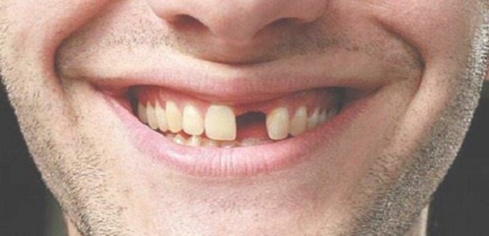 В Мелитополе в парке мужчина едва не сломал зуб о фастфуд (фото)