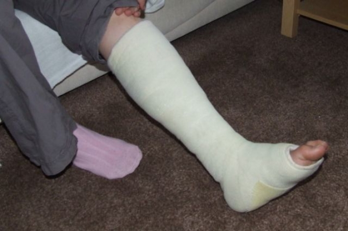 В Мелитополе рецидивист "случайно" сломал мужчине ногу
