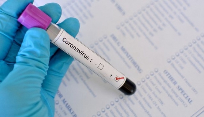 В Запорожской области растет заболеваемость коронавирусом