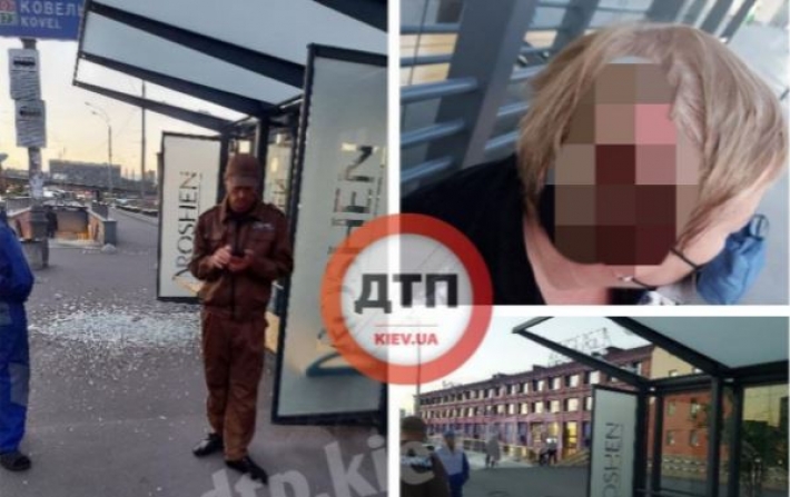 Упало стекло: в Киеве женщина получила серьезные травмы на остановке, фото