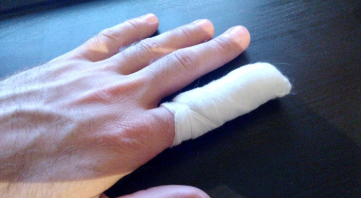 Жительница Мелитополя возле рынка сломала мужчине палец