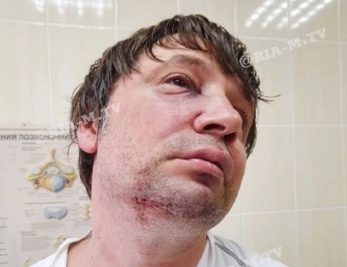 Хирург после нападения пациента в Мелитополе оказался в больнице - куда обращаться пациентам