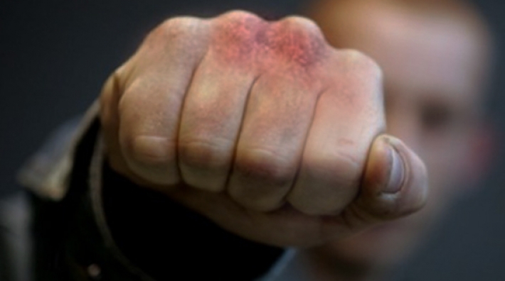 В Мелитопольском районе мужчине в драке переломали руки