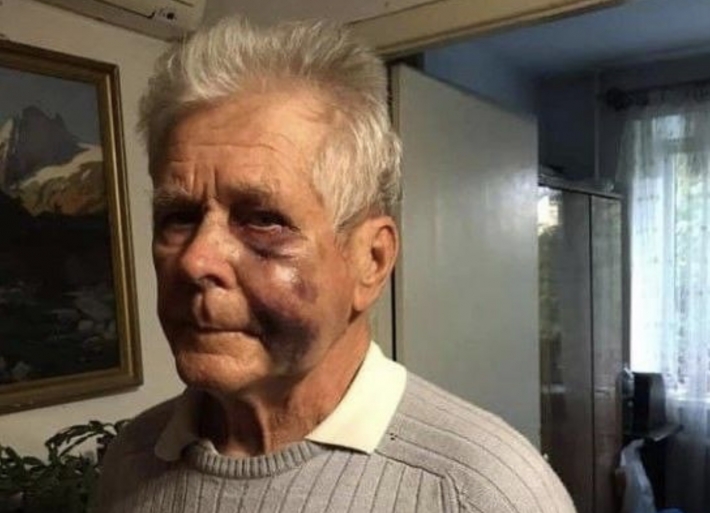 В Запорожье водителя, избившего пенсионера, будут судить за хулиганство