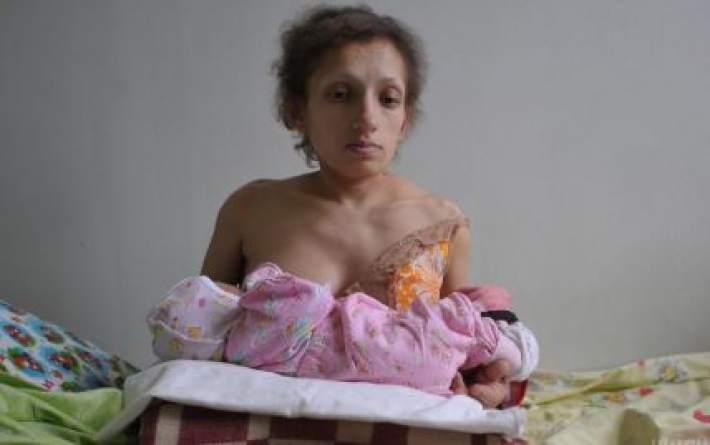 Умерла самая низкая мама в Украине: подробности