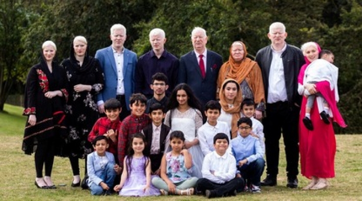 В семье пакистанцев живет 15 человек с альбинизмом, и это новый мировой рекорд: фото