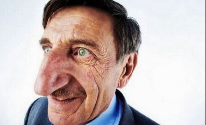 Житель Турции признан обладателем самого длинного в мире носа