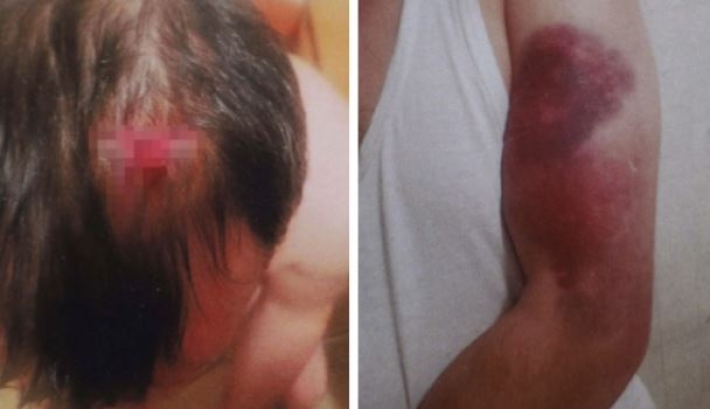 Били ломом до потери сознания: в Киеве сообщили о подозрении двум полицейским, фото