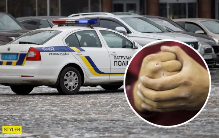 В Киеве охранник парковки разбил голову водителю, который оставил авто "не там" (фото)