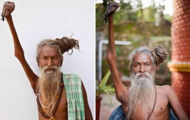 Житель Индии прожил полстолетия с поднятой вверх рукой