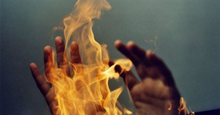 В Запорожской области мужчина получил серьезные ожоги, разжигая печь