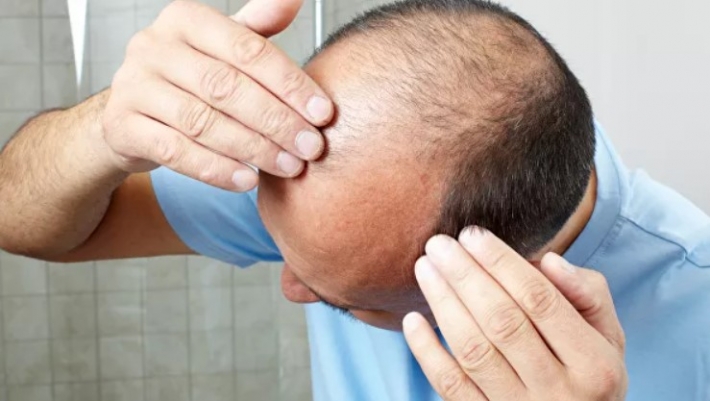 Прорыв в изучении выпадения волос: ученые выяснили, что может улучшить их рост