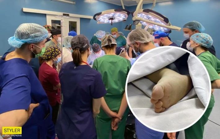 Впервые в Украине годовалому малышу трансплантировали печень от посмертного донора (фото)