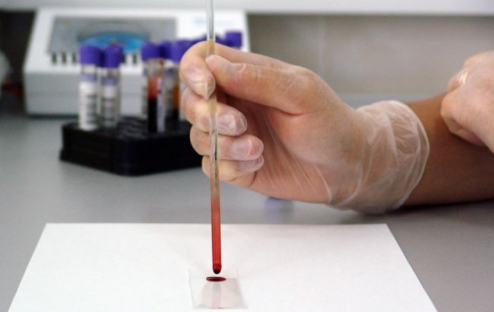 Ученым удалось открыть группу крови долгожителей