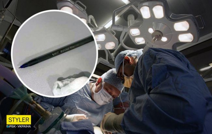 Украинец из-за спора проглотил шариковую ручку и попал на операционный стол (фото)