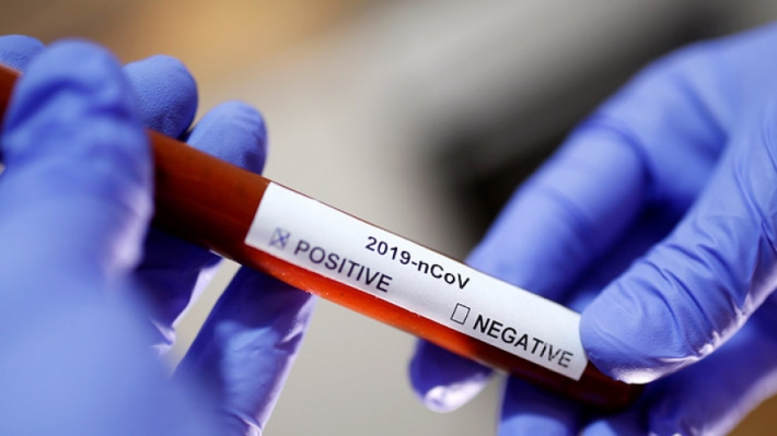 В Запорожской области ухудшается ситуация с заболеваемостью коронавирусом