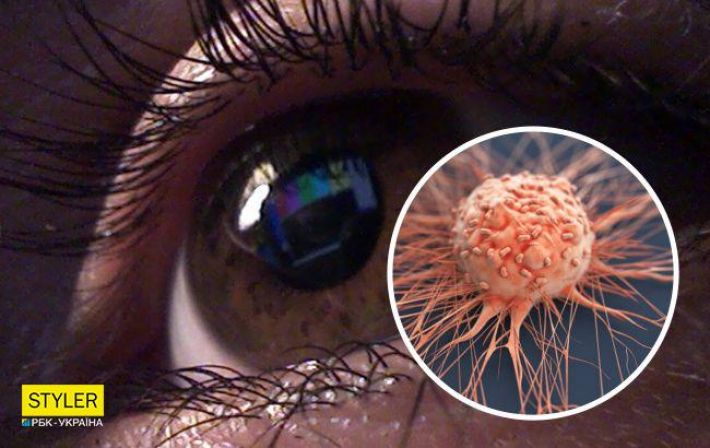 Названы симптомы и ощущения в глазах, которые могут указывать на рак