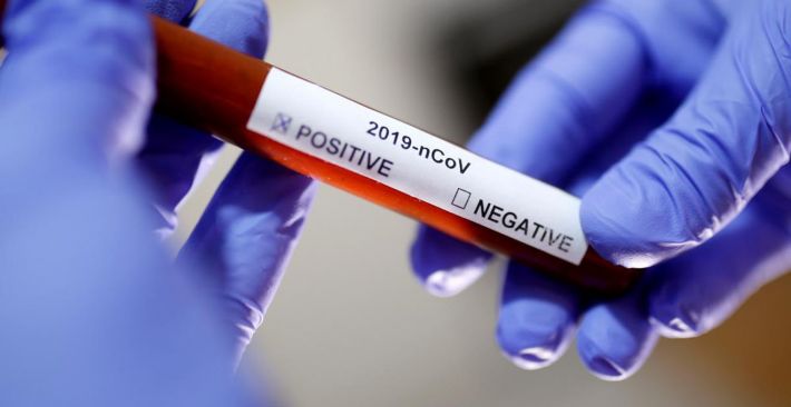 В Мелитополе коронавирусом заболели 24 человека, двое умерли