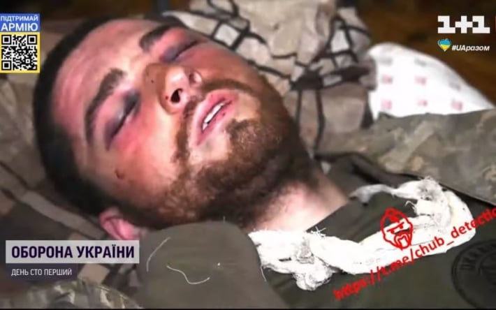 Со сломанным тазом и осколками в глазах россияне держали в плену украинского морпеха без всякой медицинской помощи