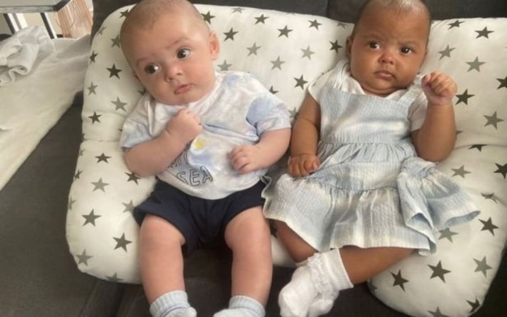 В Великобритании женщина родила близнецов с разным цветом кожи