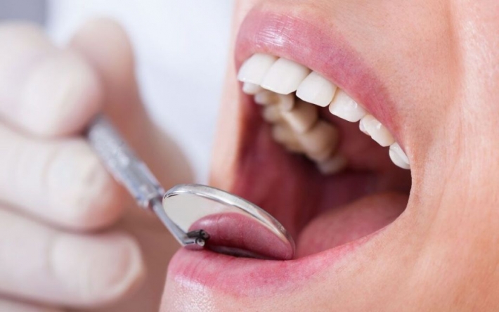 Вы об этом точно не знали: если есть проблемы с кишечником, могут выпадать зубы