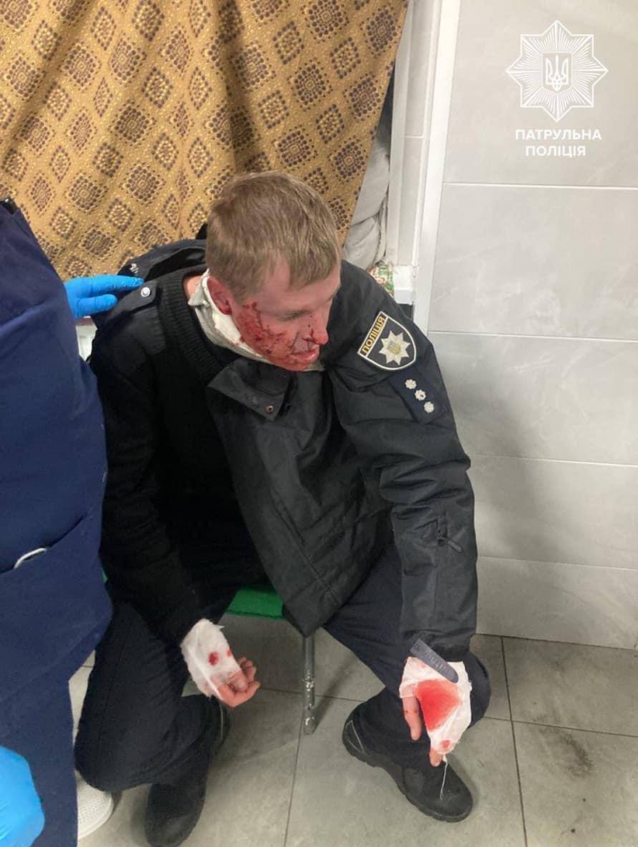 В результате утреннего обстрела Запорожья пострадали полицейские и гражданский 4