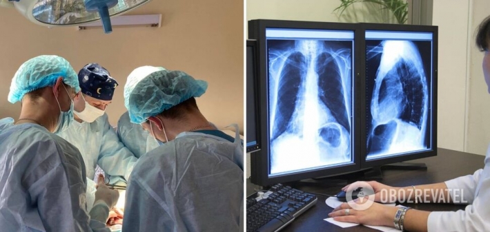 Тривала 16 годин: у Львові провели унікальну операцію з пересадки легень від посмертного донора