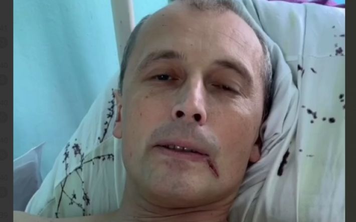 Оставшаяся часть тела подорванного коллаборанта из Мелитополя уже жалуется путину – его плохо лечат (видео 18+)