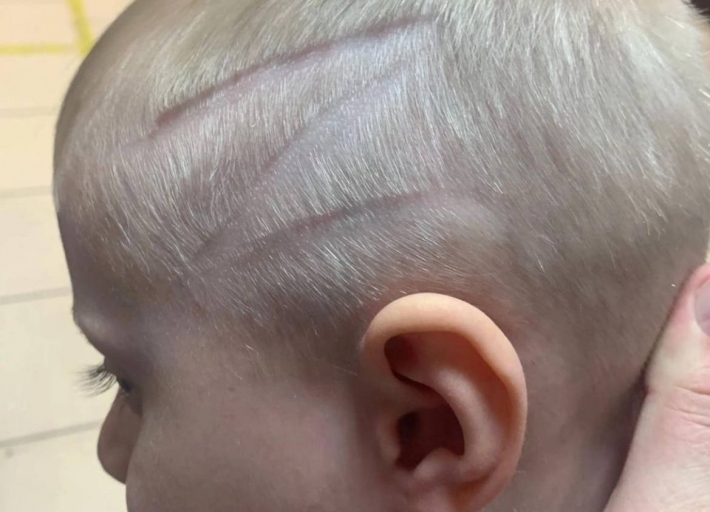 Жительница Мелитополя выбрила свастику на голове у собственного ребенка (фото)