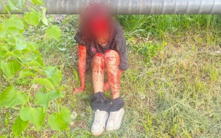 У Росії офіцер ЧФ зґвалтував школярку та намагався вбити каменем по голові (фото)