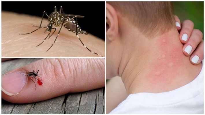 Комарам не нравятся эти запахи: 6 натуральных средств, отпугивающих насекомых-кровососов