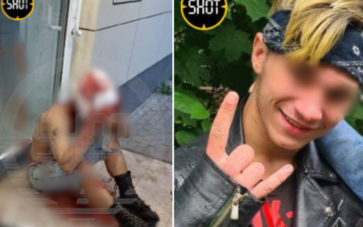 В РФ 19-летнему парню сняли скальп из-за зеленого ирокеза (фото)