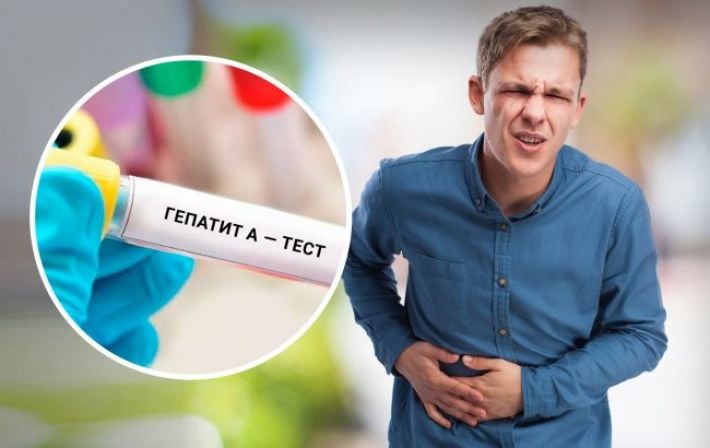 В Україні "розгулявся" гепатит А. Як він передається, перші ознаки та профілактика