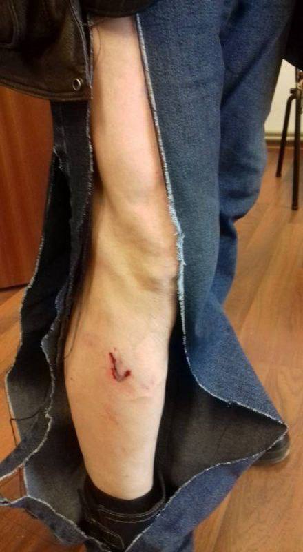 В Мелитополе стая агрессивных бездомных собак напала на 19-летнюю девушку (фото)