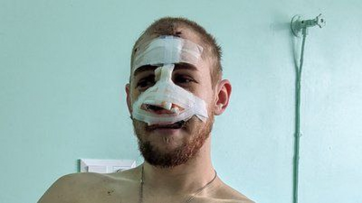 24-летний Александр Петров получил многочисленные ранения во время обстрела Запорожья 8 января