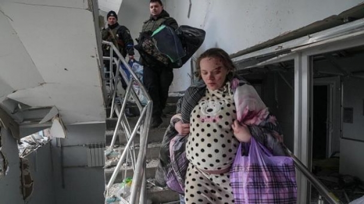 "Конечная точка дна": девушка, выжившая после обстрела роддома в Мариуполе, поддержала Путина