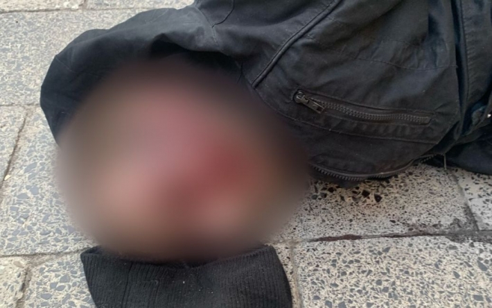 Неизвестный с бритвой напал на студентку в туалете университета во Львове: как все закончилось (фото)