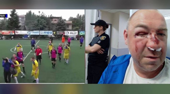 У Запоріжжі під час футбольного матчу сталася бійка між патрульною поліцією і підлітками (відео 18+)